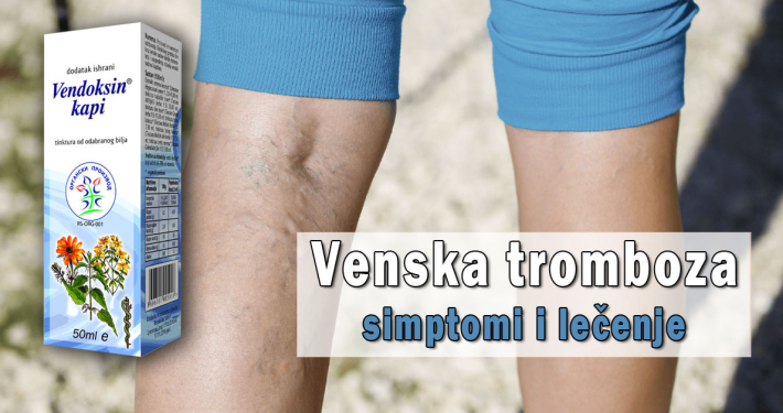 Venska tromboza - simptomi i lečenje