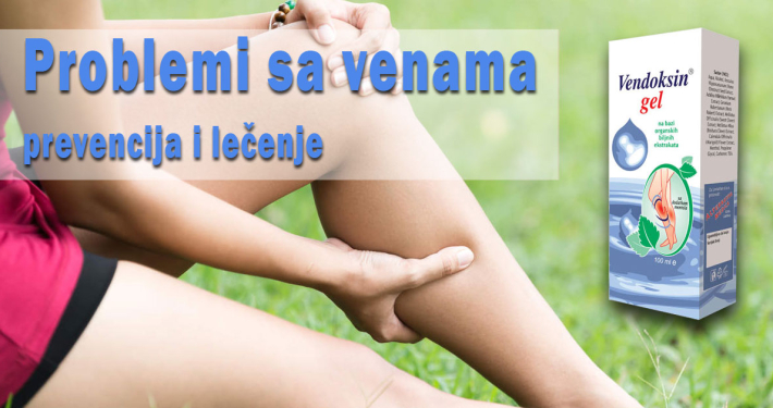 Problemi sa venama - prevencija i lečenje