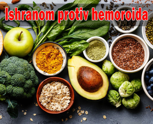 Ishranom protiv hemoroida