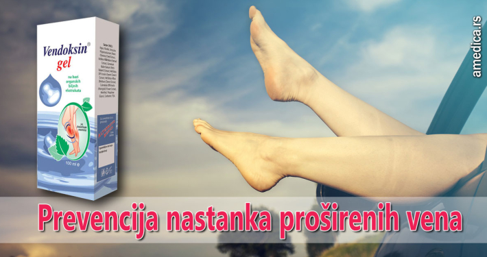 Prevencija nastanka proširenih vena