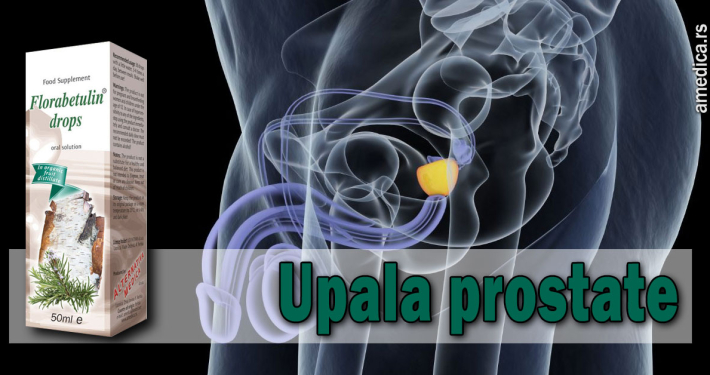 Upala prostate