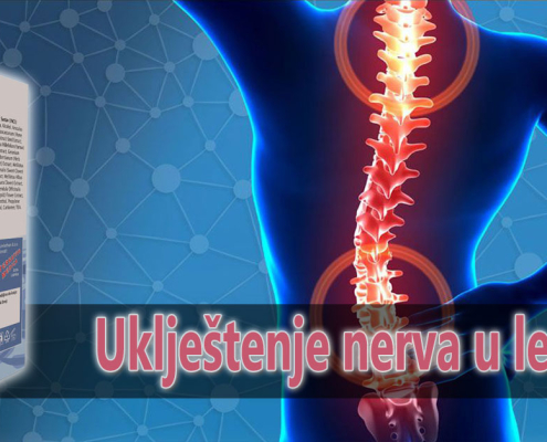 Uklještenje nerva u leđima