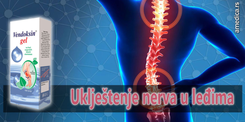 Uklještenje nerva u leđima