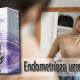 Endometrioza uzroci i lečenje